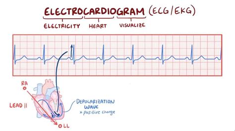 ecg for dummies|ECG basics: Video, Anatomy, Definition & Function .